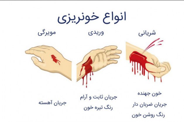 کمک های اولیه در در زخم و خونریزیها